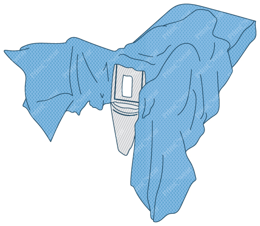 CYSTOSCOPY DRAPE